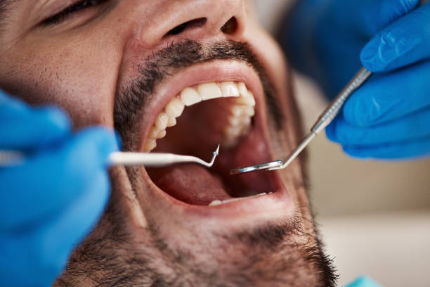 Best Pediatric Emergency Dentist in St James City, FL