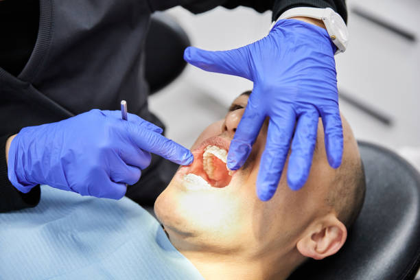 Best Emergency Tooth Extraction in St James City, FL