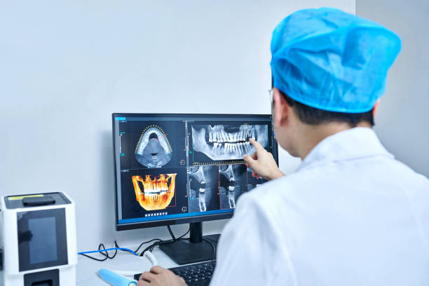 Best Emergency Tooth Extraction in St James City, FL
